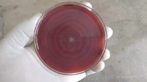 Swarming growth of Proteus on blood agar