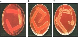 FileShigella-culture.png by Prakash R1, Bharathi Raja S, Devaraj H, Devaraj SN. is licensed under CC BY 4.0.