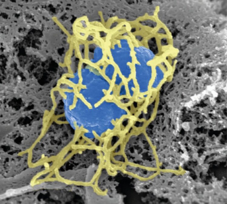 Neisseria Meningitidis