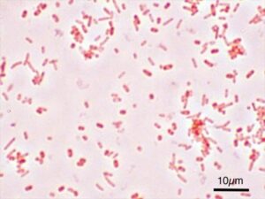 File:Salmonella Typhimurium Gram.jpg