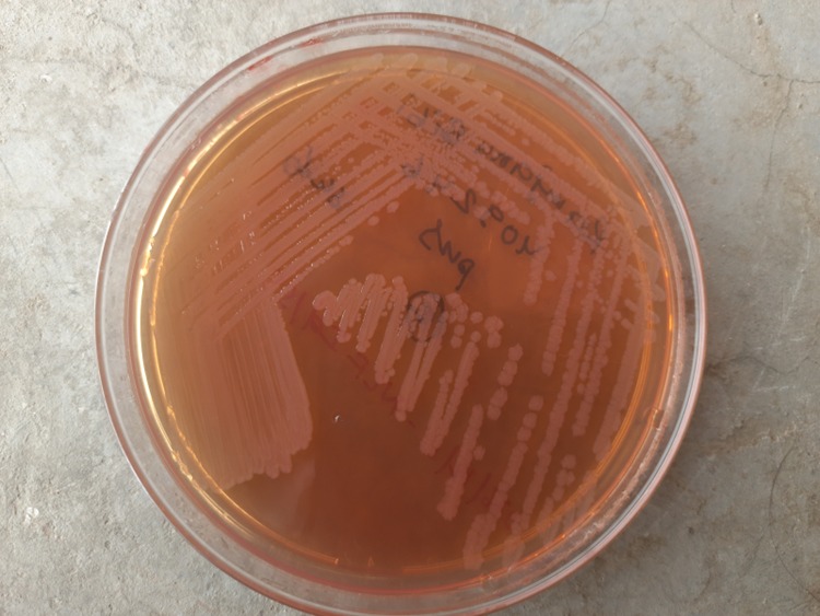 Salmonella Typhi