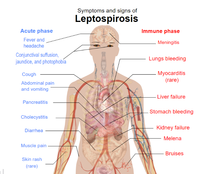 Leptospira Interrogans