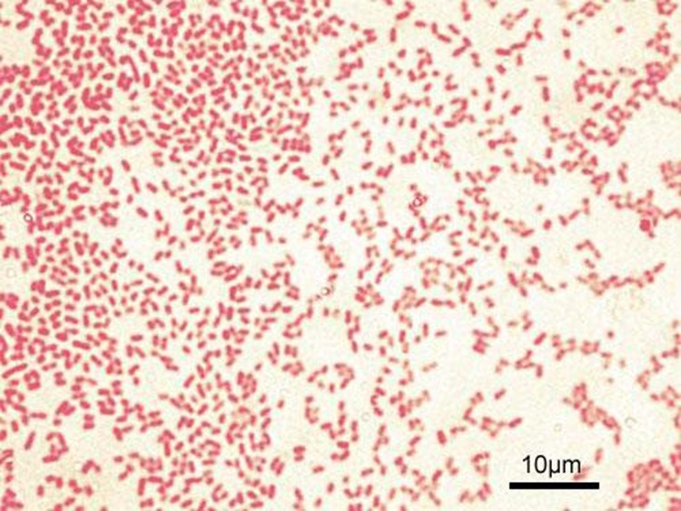 Pseudomonas Aeruginosa